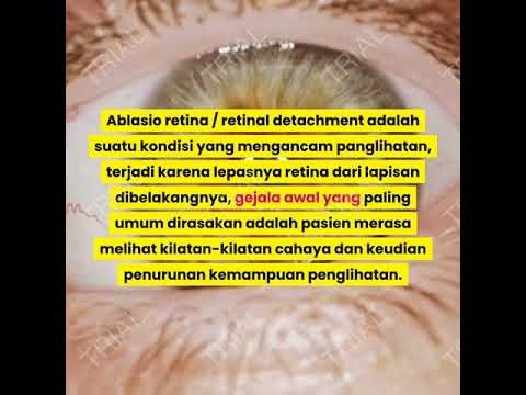 efek setelah operasi ablasio retina