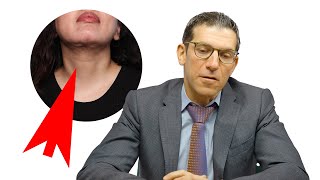 Considering Submental (Double Chin) Liposuction? Watch This First! Pitfalls and Cons of Chin Lipo
