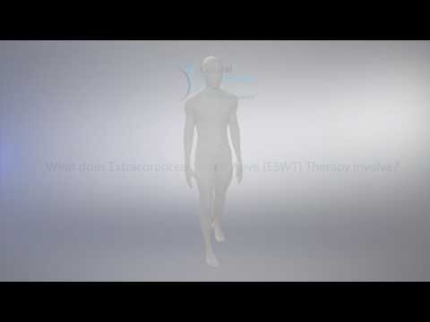 Shockwave Therapy for Shoulder Tendinopathy or Shoulder Tendinitis, Supraspinatus Tendinopathy.