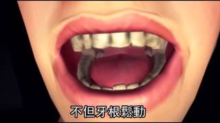 3年流產4次  牙周病害的--蘋果日報 20141219