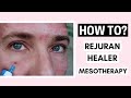 Rejuran Healer Skin Booster Mesotherapy Before And After Ft. @Christopher McGrady