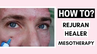 Rejuran Healer Skin Booster Mesotherapy Before And After Ft. @Vanidiy