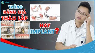 Trồng Răng Giả Tháo Lắp Được Bao Lâu Chia Sẻ Từ Bác Sĩ Nha Khoa Lạc Việt Intech