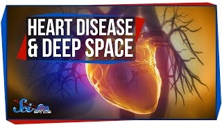 Does Deep Space Cause Heart Disease?