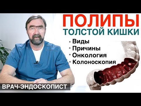 ПОЛИПЫ ТОЛСТОЙ КИШКИ - причины появления полипов, симптомы полипов, диагностика полипов в кишечнике