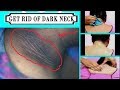 How to Get Rid of Dark Neck Fast and Easy|Natural Remedy| Brown skin around neck