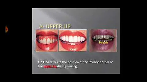 Operative 8 ; Lec 2 ; Esthetic Considerations in conservatie dentistry part 2