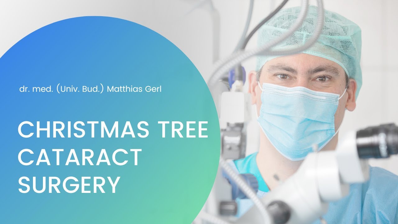 Christmas Tree Cataract Surgery YouTube