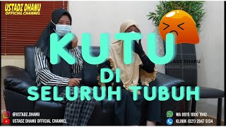 KELUAR KUTU DARI SELURUH TUBUH - RUANG PRAKTEK USTADZ DHANU