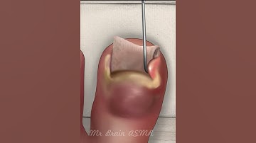 ASMR Relaxing Ballerina Ingrown toenails and feet massage 🌿 for deep sleep #asmr #relax #animation