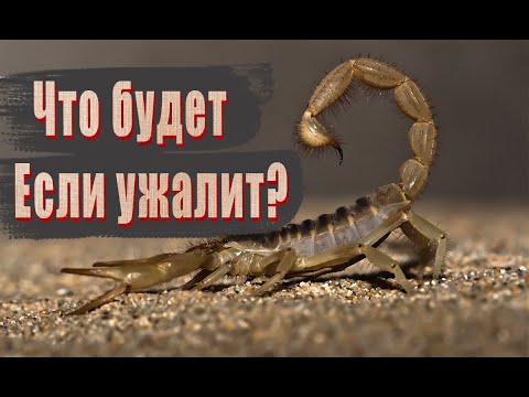 ЧТО БУДЕТ ЕСЛИ УЖАЛИТ СКОРПИОН ? / ПОСЛЕДСТВИЯ УКУСА СКОРПИОНА В РОССИИ