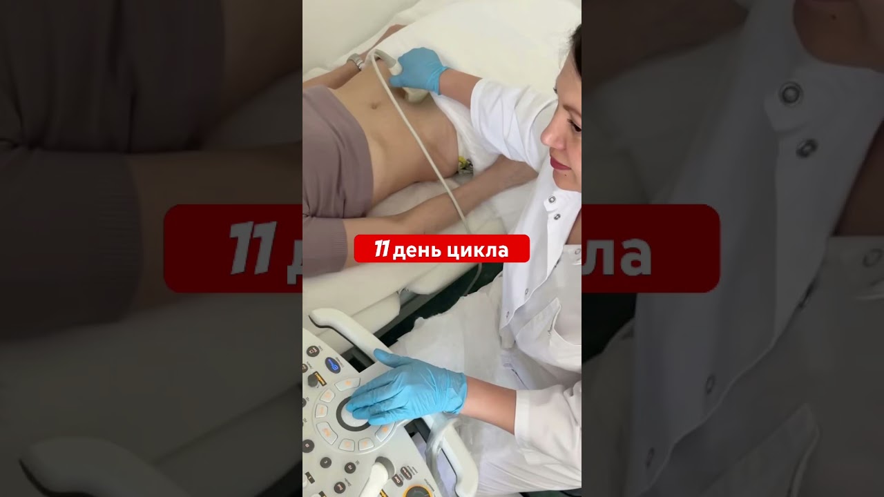 Планирование беременности, Овуляция , Фолликулометрия,тесты на овуляцию