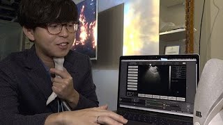 ソニーの農業、ソニーの義足　研究所を公開