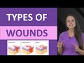 Understanding Skin Wounds