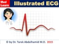 ECG INTRODUCTION Usmle Internal Medicine Cme Ecg كورسات باطنة محاضرات باطنة Medical 