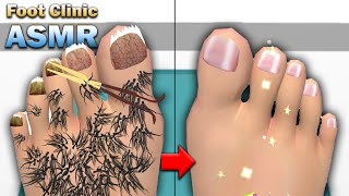 MAX LEVEL in Foot Clinic - ASMR Feet Care iOS/Android Game screenshot 4