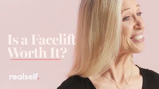 Is a Facelift Worth It? Everything You Need to Know About This Facial Plastic Surgery Procedure