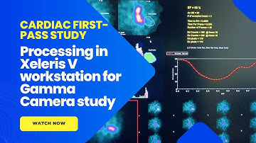 Cardiac First Pass Study Processing Simplified on Xeleris V Workstation