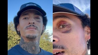 Download lagu Nyjah Says Brutal Slam Caused a Week of Memory Loss & Non Stop Vomiting, Urges Kids to Wear Helmets
