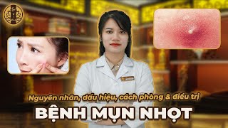 Mụn Nhọt - Nguyên Nhân, Dấu Hiệu, Cách Phòng & Điều Trị Tuệ Y Đường