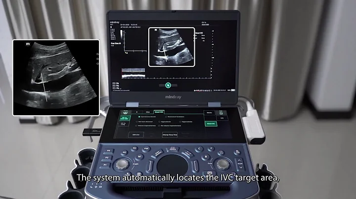 Mindray-ME Smart IVC Demonstration