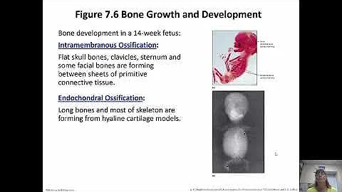 Skeletal System Chapter 7 Part 1