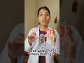 “Doctors Burn Percentage कैसे Calculate करते हैं? | Rule of 9 Explained”#doctor #medicalstudent