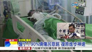 【中視新聞】醒了！90%燒傷呂意銘 復原進步神速20150701