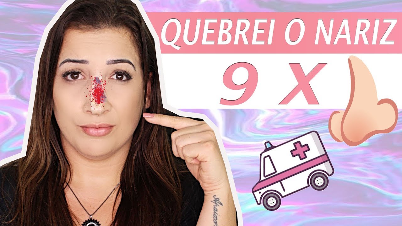 Como Saber Se Meu Nariz Quebrou - FDPLEARN