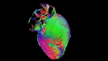 Diffusion tensor imaging (via MRI) of the heart