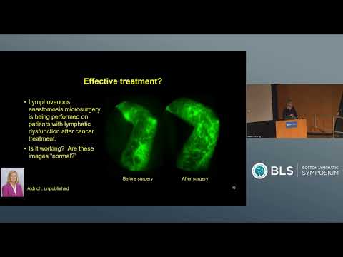 Lymphatic Function & Anatomy in Lipedema: Insights from ICG Lymphography – Sevick-Muraca | BLS 2026