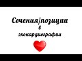 Эхокардиография. Сечения/позиции на ЭхоКГ.