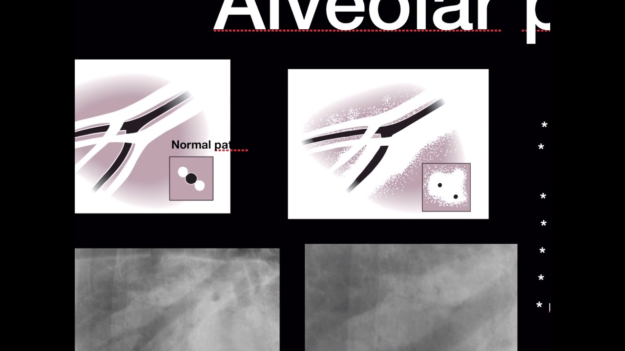 Kedi ve Köpeklerde Akciğer Paternleri (X-Ray)