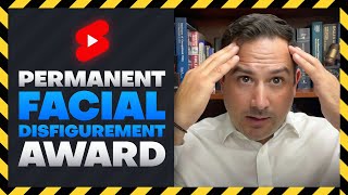 Facial Awards: Money for Permanent Facial Disfigurement
