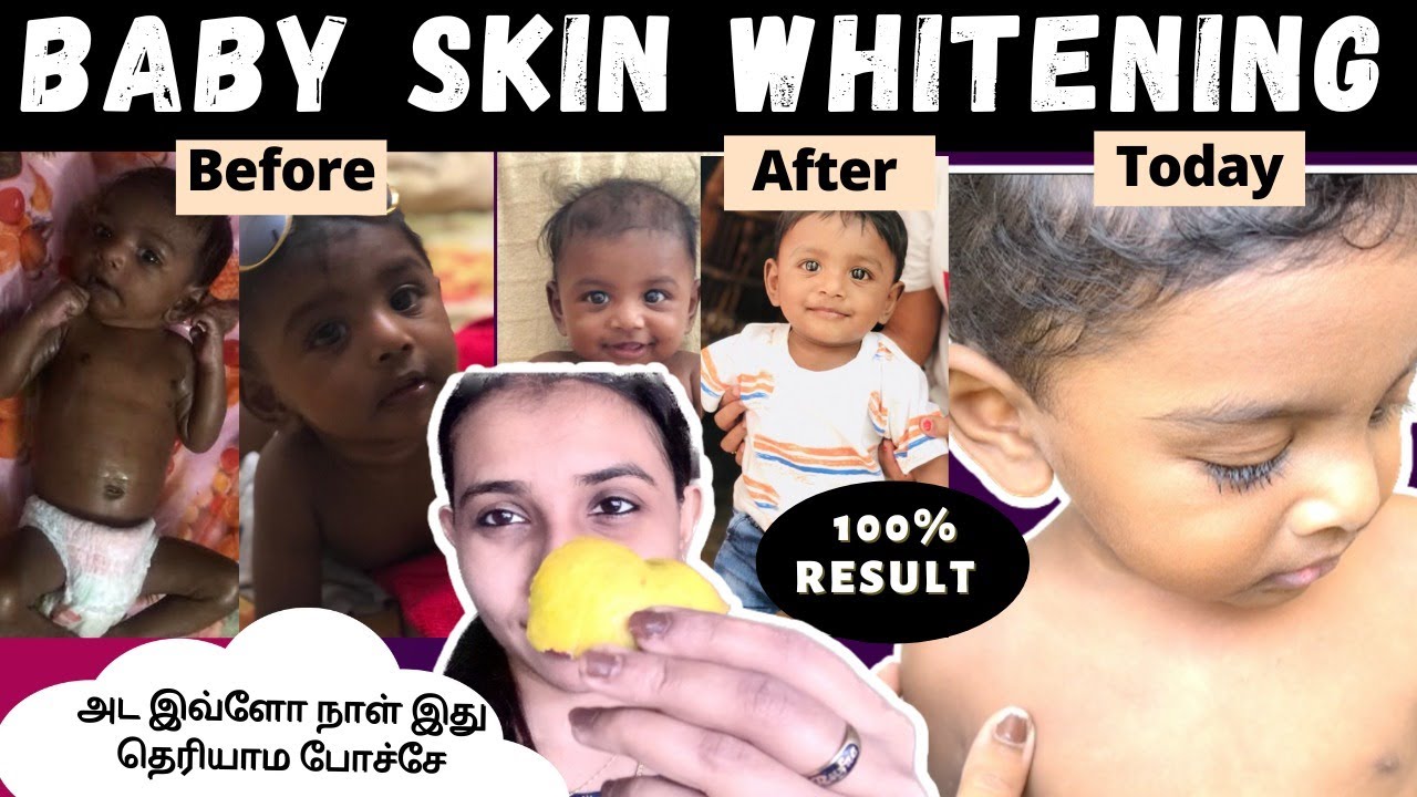 Best baby skin whitening tips Orange peel pack YouTube