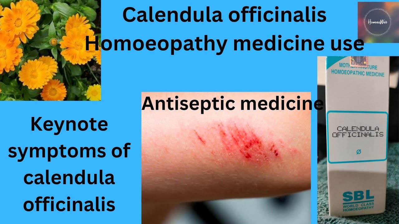 calendula officinalis Homoeopathy mother tincture use antiseptic