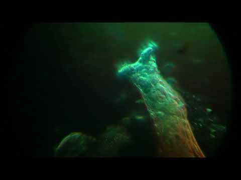 How To Reconstitute And Inject Peptides tcEWjyQfDLc