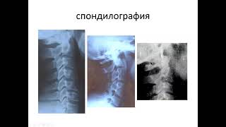 9. Вертеброгенные заболевания нервной системы / Vertebral diseases of the nervous system