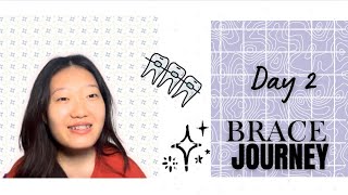 Braces Day 2😬 | Pain, Struggles & What I Ate 🍜| AKKU NISSO🌷