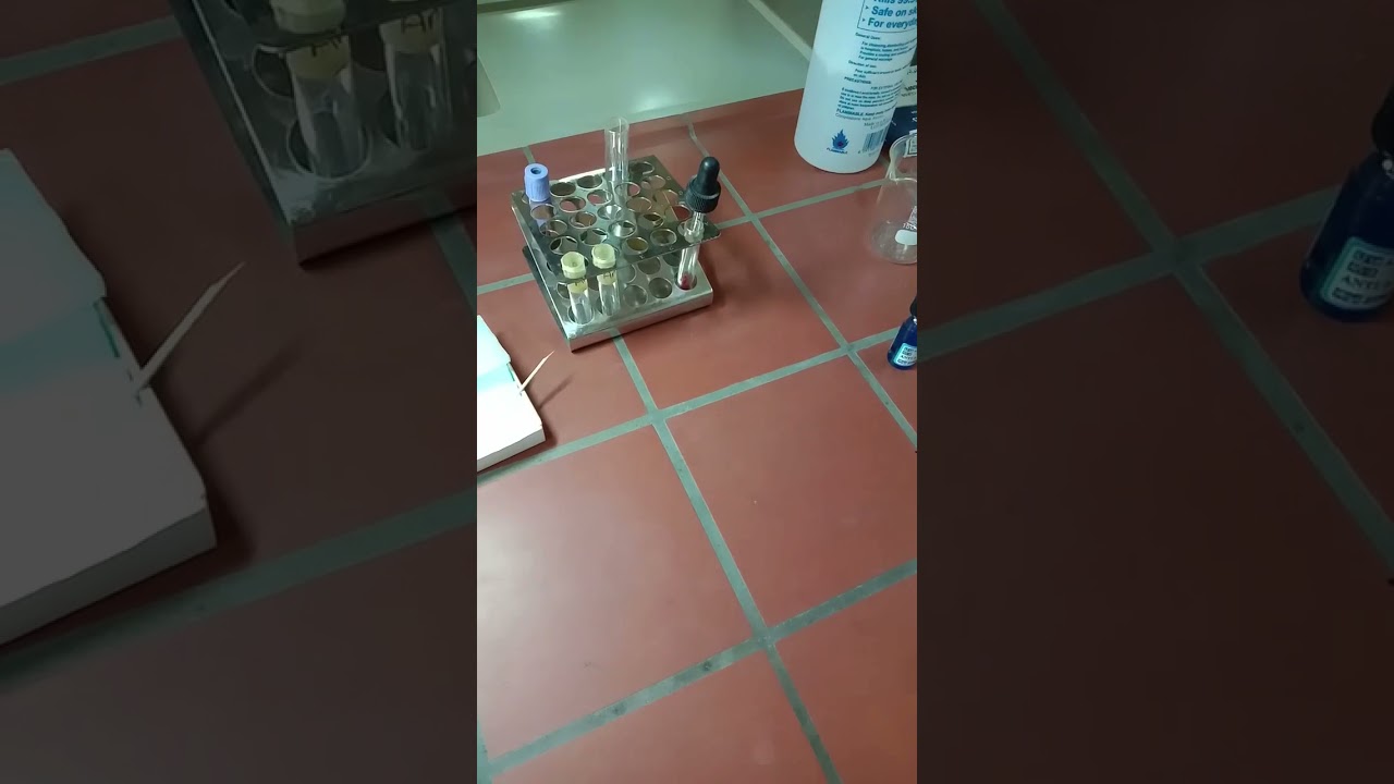 كيفية إجراء اختبار تحديد نوع فصيلة الدم بطريقة Tube method