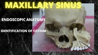 045. Anatomy Maxillary Sinus.  #anatomylectures