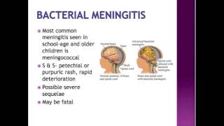 Neuro Part 3 MENINGITIS, REYE
