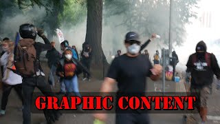 Footage: George Floyd Protests in Portland, Oregon
Patreon to Support this Channel: https://Patreon.com/zachmoss
Twitter: https://twitter.com/ZachMoss6
Facebook: https://www.facebook.com/ZachMoss6
Instagram: https://www.instagram.com/thezachofzachs/
Sources:
https://www.youtube.com/watch?v=Mtw6mx4pBfM
#GeorgeFloyd #Protest2020 #Portland #Oregon #TheZachMossShow #ZachMoss6 #ZachMoss #Protest #BlackLivesMatter Footage: George Floyd Protests in Portland, Oregon