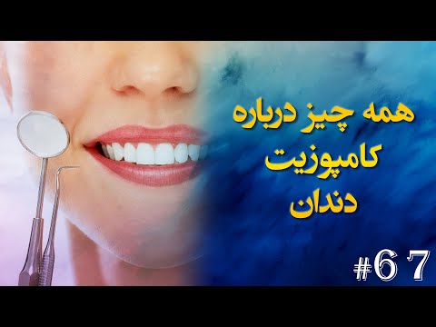 تصویری: درهای کامپوزیت از چه چیزی ساخته شده اند؟