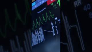 CHF Exacerbation Red Flags Explained | RN Explains 123