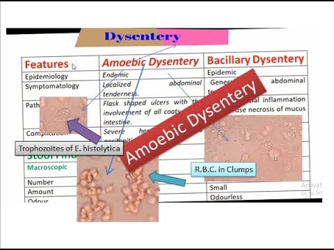 amoebic dysentery