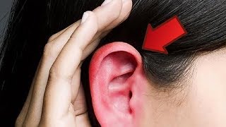 O que significa de orelha a orelha?
