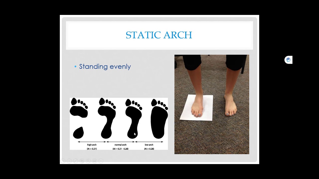 Lab #1 - Arch and Foot Type & Lacing Techniques - YouTube