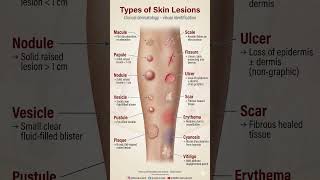 Types of Skin Lesions You Must Know | Dermatology in 30 Sec #dermatology #generaldermatology