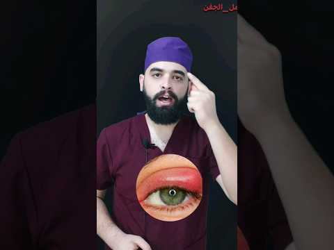 دمل العين الاسباب و العلاج دمل العين دمل الجفن تورم العين تورم الجفن العين امراض العين
